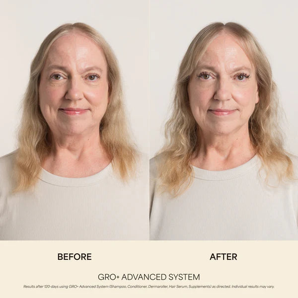 GRO+ Advanced Balancing Conditioner