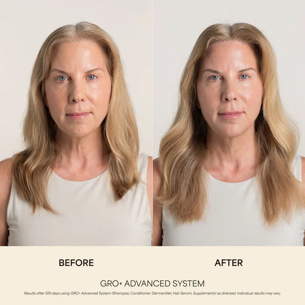 GRO+ Advanced Balancing Conditioner