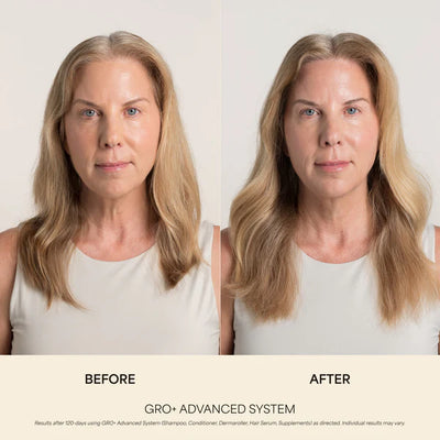 GRO+ Advanced Balancing Conditioner